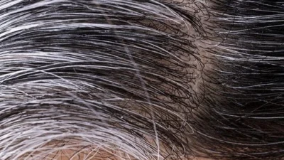 Yaşlanma belirtisi olarak bilinen saç beyazlaması biyolojik ve çevresel faktörlere