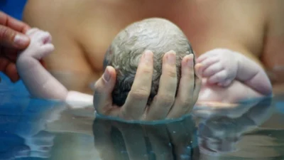 Kadın Hastalıkları ve Doğum Uzmanı Dr. Refika Gasimova, suda doğumun